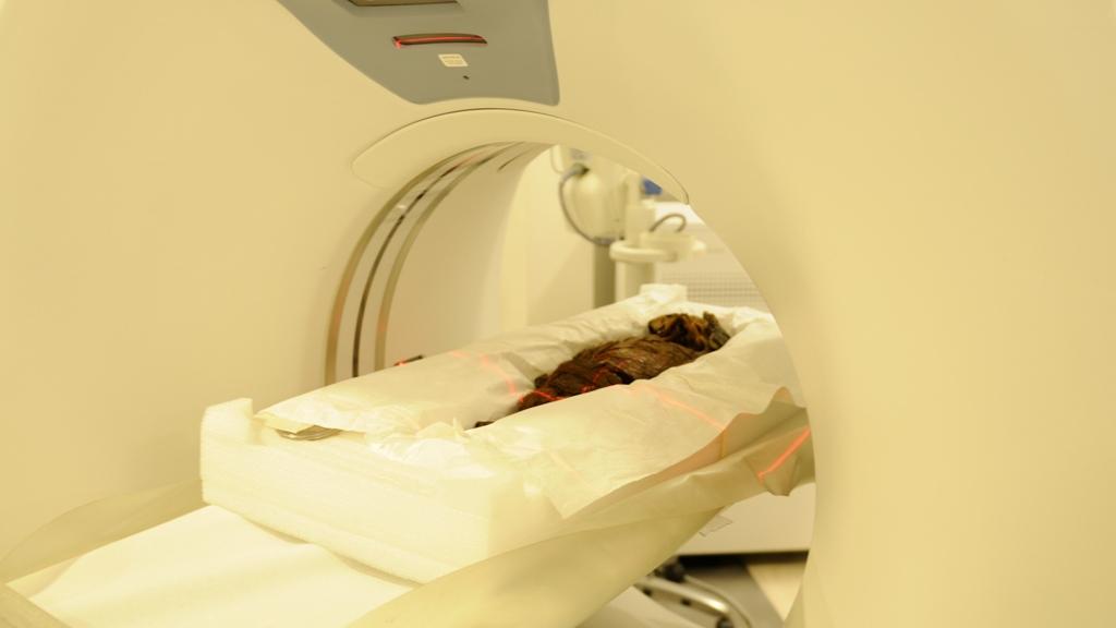 Proceso de tomografía del cuerpo real.