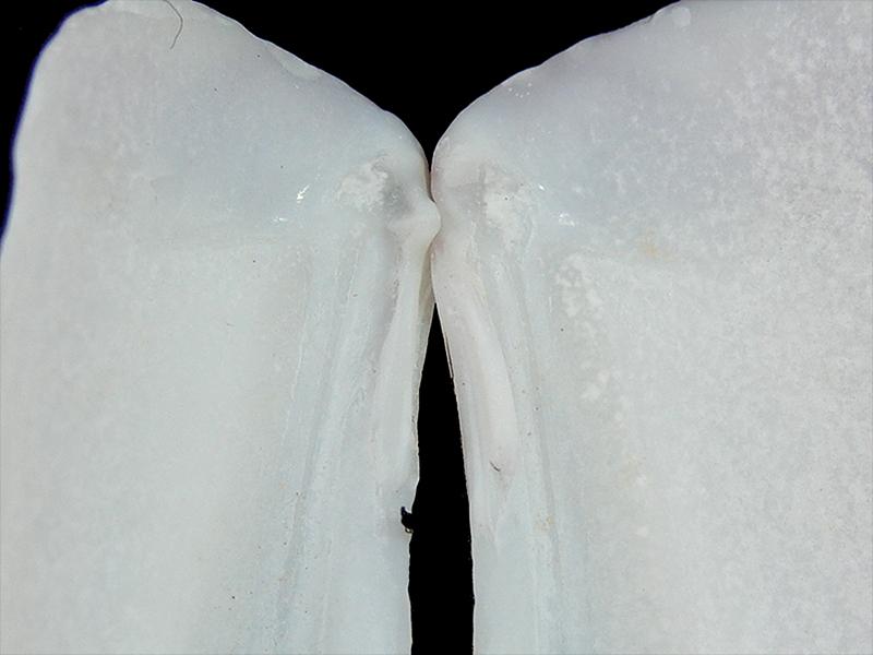 Tagelus (Taelus) dombeii (detalle)